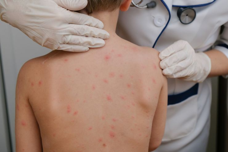 Pediatric Dermatology